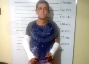 Sufrió una caída en un robo, se fracturó los brazos y escapó enyesado del Hospital Central