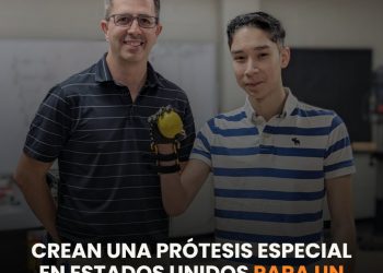 Crean una prótesis especial en Estados Unidos para un joven que nació sin una mano