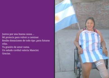 Sanrafaelina sufrió la  amputación de una pierna y para comprar la prótesis vende empanadas