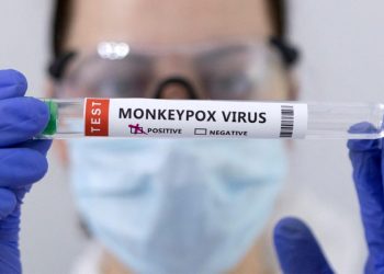 Formosa: detectan el primer caso de Viruela Símica en un paciente de 23 años