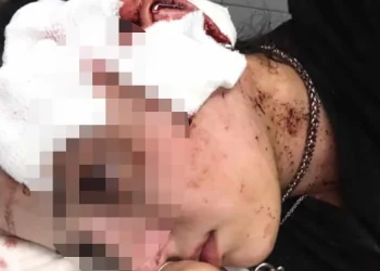 Ciudad Mendoza: Le reventaron un vaso en la cabeza a una moza en la Arístides y casi los lincharon