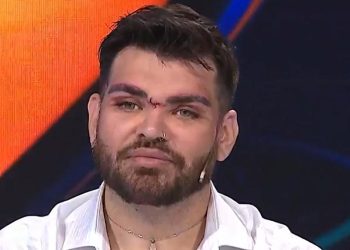 «Me desfiguró»: el drama de Fran Mariano tras la mala praxis de Aníbal Lotocki