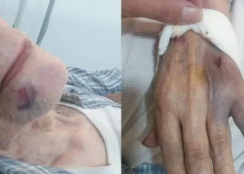 Inseguridad brutal en Córdoba: Tiene 91 años y lo molieron a golpes para robarle «los ahorros de toda su vida»