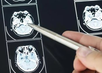 Cada día se detectan en Argentina 5 casos de tumores cerebrales: ¿Cuáles son los signos de alerta?