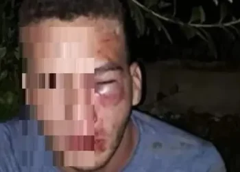 Acoso sexual: Pactó un encuentro con una nena y la familia de ella lo desfiguró
