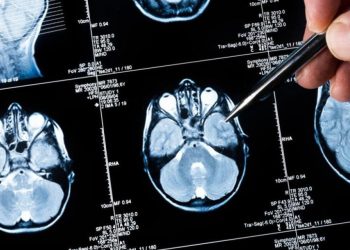 Gracias a la Inteligencia artificial, logran analizar el ADN del cáncer cerebral durante una operación