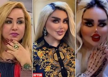 Impactante: se hizo 43 cirugías para parecerse a Barbie