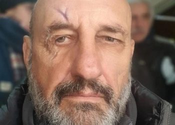 Escándalo total: «El Puma» Goity protagonizó una pelea con el director de su obra y la policía debió separarlos