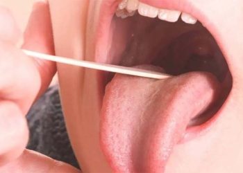 Aumentan los casos invasivos por estreptococo y advierten importancia de no subestimar los síntomas