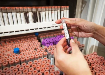 Análisis sin copago: cuáles son las obras sociales que acordaron con los bioquímicos