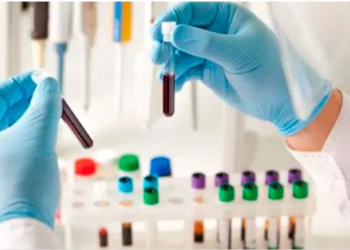 Ahora también piden “copago”: Bioquímicos de Mendoza empezaron a cobrar $4800