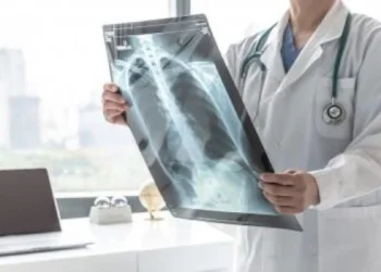 Presentan en el país un nuevo tratamiento para un tipo de cáncer de pulmón