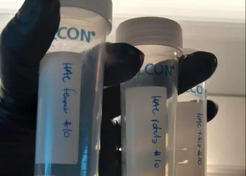 Los proyectos de dos startups mendocinas que prometen revolucionar la salud