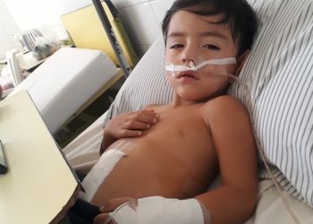 Un niño sanrafaelino tiene una extraña mutación genética y necesita ayuda de la comunidad