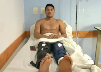 Insólito: un joven fue a hacerse una cirugía en la rodilla y le operaron las dos piernas