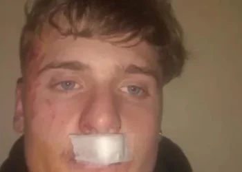 Un joven recibió una brutal golpiza por parte de rugbiers en Zárate: “Pudo ser como Fernando Báez Sosa”