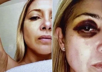 Para el Gobierno, la Justicia «debería ordenar la detención» de Alberto Fernández