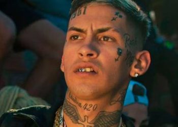 L-Gante mostró su nueva sonrisa: el antes y después de su retoque estético en los dientes