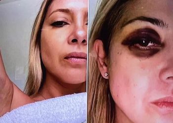 Lo peor de Alberto Fernández: terribles fotos de la golpiza a Fabiola y polémico video con Tamara Pettinato