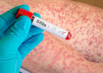 Sífilis en jóvenes: el Concejo Deliberante impulsa políticas de prevención