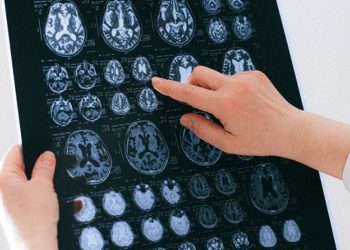 Día Mundial de la Lucha contra el ACV: charlas para la comunidad y el personal de salud en San Rafael