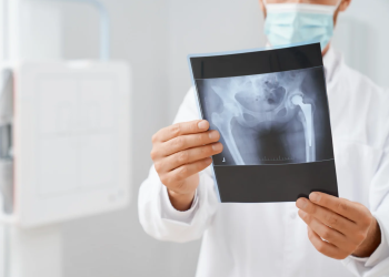 PAMI vs. traumatólogos: afiliados perjudicados y reclamos económicos en el centro del conflicto