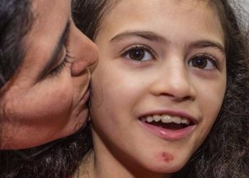 Síndrome de Cri du Chat: una realidad poco visible que reclama inclusión