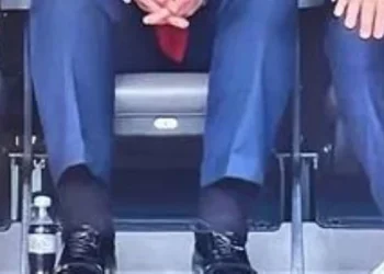 Trump fue diagnosticado con insuficiencia venosa crónica