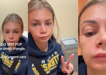 Se explotó un grano en “el triángulo de la muerte” de la cara, quedó internada de urgencia y los detalles son fuertes