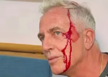 Marley se accidentó en Tailandia y preocupó a todos: “Quedé chorreando sangre”