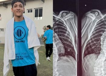 Piden ayuda para Sebastián Ferreyra: joven sanrafaelino al que operarán de la columna en el Hospital Notti