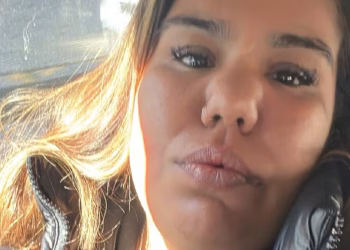 Cómo fue el accidente doméstico que sufrió Camilota de “Cuestión de peso” 