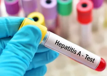 Preocupación por aumento de la hepatitis A: en qué provincias hay casos confirmados